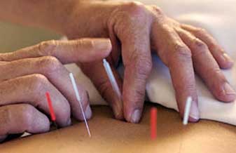 Clínica de Fisioterapia e Acupuntura Dr Darcio - Foto 1