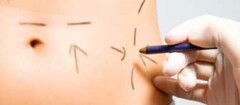 cirurgia-plastica-varginha-1375808316
