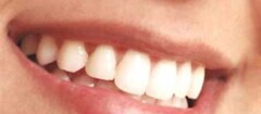 implantes-dentarios-varginha-1376332770