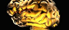 neurologia-varginha-1376334603