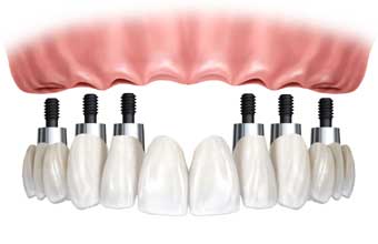 Laboratório Brasil Prótese Dentária - Foto 1